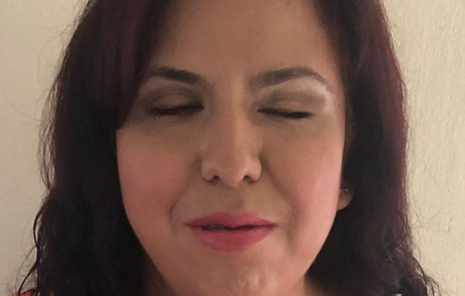 Photo of a fair skin woman with dark hair